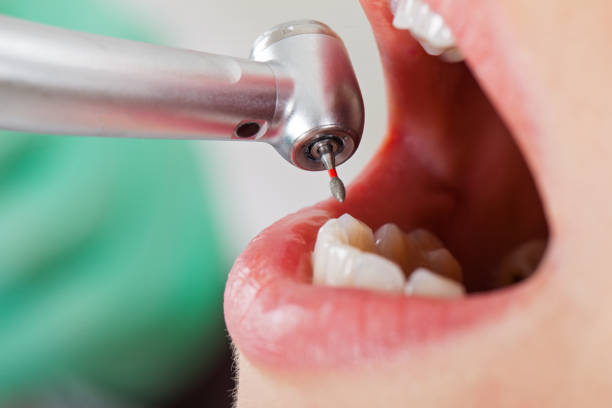 Best Pediatric Emergency Dentist in National City, CA